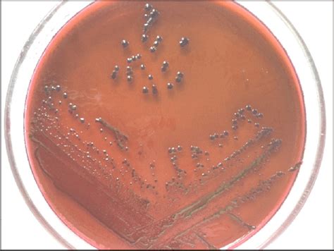 coli strain  levine     biochemical activity  api