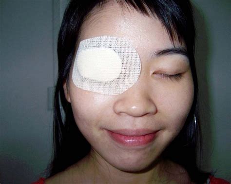 10pcs Sterile eye patch Medical non woven eye patch eyeshade eye pad ...