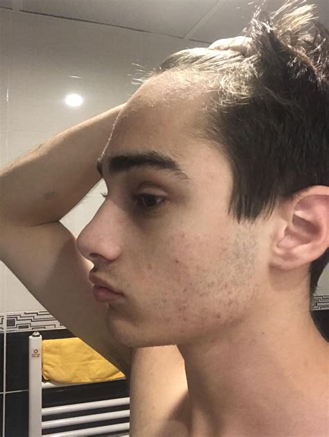 Amazing Hairstyles For Men With Receding Hairlines And Big Foreheads