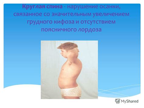 Презентация на тему: "«Нарушение осанки в детском возрасте».. Задачи: 1 ...