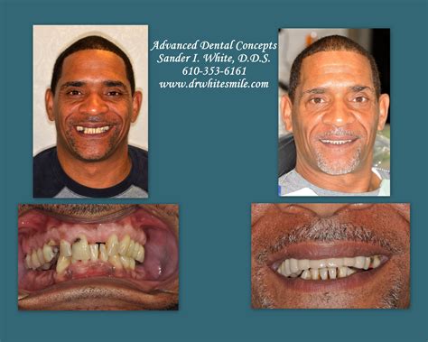 Jw Woodward: Before & After Results That Will Shock You Image 17