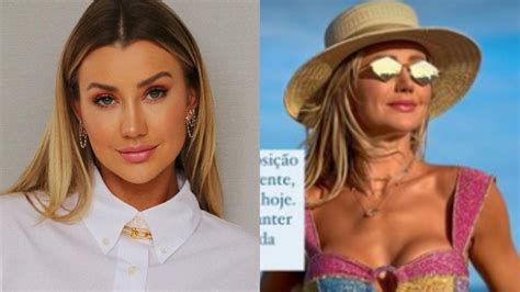 Ana Paula Siebert Justus Antes E Depois