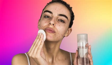10 Easy DIY Skincare Routines for Acne-Prone Skin