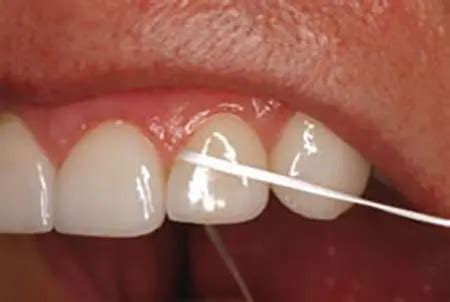 Why and How Should I Floss? - Oral Hygiene - Twinkle Family Dentalcare