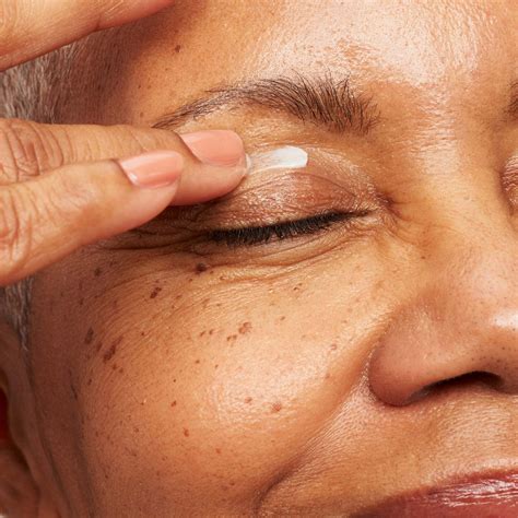 How to Apply Eyelid Cream When You Have Eczema: Expert Tips - Bolsa de