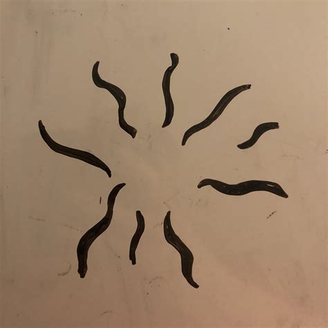 Patterns In My Eye After Waking Up (Looks Like The Photo Attached) : r