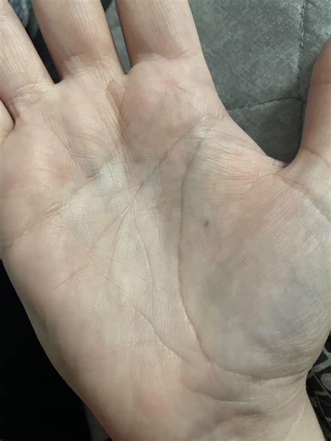 33 year old mark : r/PencilStabbers