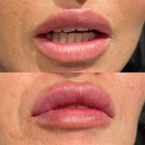 Flawless Medical Cosmetics - Skin Rejuvenation Clinic Bournemouth