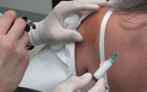 Double Type Shoulder Cortisone Injections! Ribs?? | Cortisone injection ...