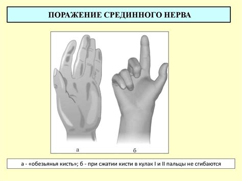 Спинномозговые нервы - презентация онлайн