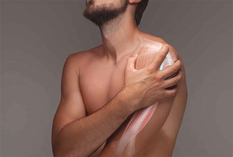 Tendinite Distal Do Biceps