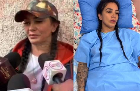 'Wanders Lover' confiesa que sufrió una amputación - Diario de Yucatán