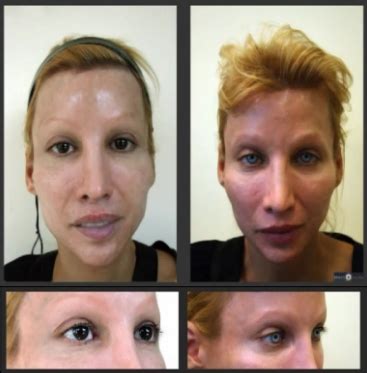 how to change the colour of your eyes permanently