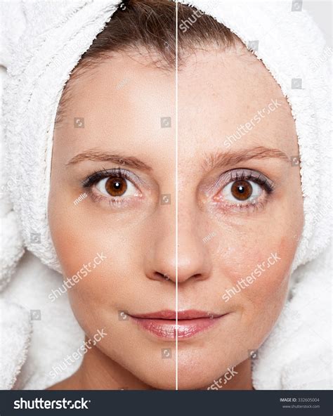 Beauty Concept Skin Care Anti-aging Procedures Stock Photo 332605004 | Shutterstock