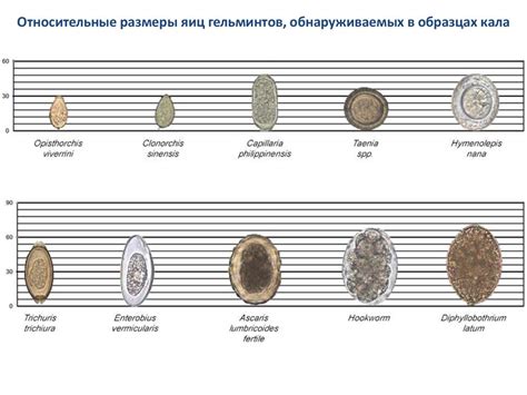 Кишечные гельминтозы - презентация онлайн