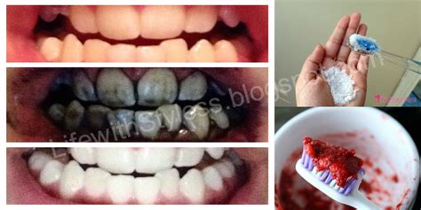 Tips To Whiten Your teeth Naturally - Must Check! | Life With Styles