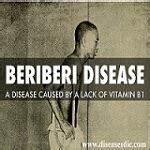 beriberi risk factors manifestations  diagnosis