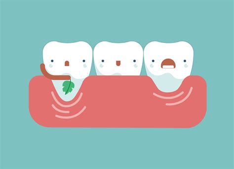 how to treat gum recession