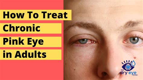 how long to stay home with pink eye