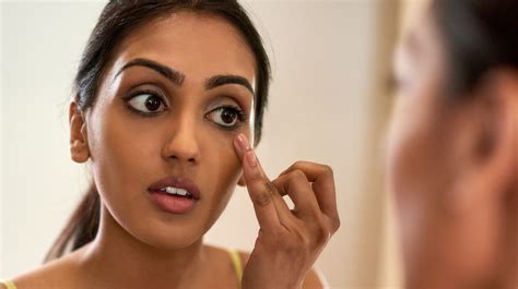 Raccoon Eyes: Causes, Treatment, and How to Get Rid of It - Bodycraft ...
