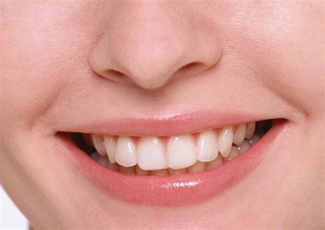 Snap- on Smile: l’implantologia alternativa - Migliora Vita - 2026
