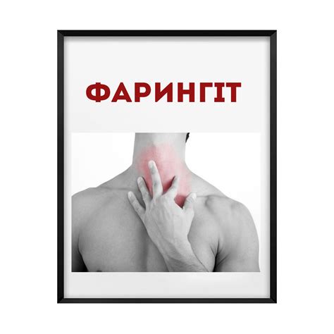 Фарингіт | Клініка Сміянових