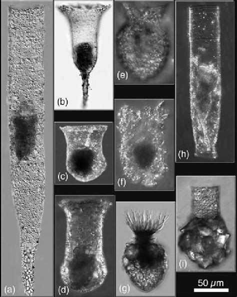 tintinnid species  agglutinated loricae tintinnopsis radix