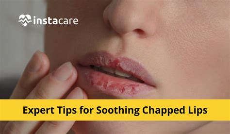 expert tips  healing dry chapped lips