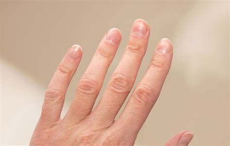 7 fingernail problems not to ignore