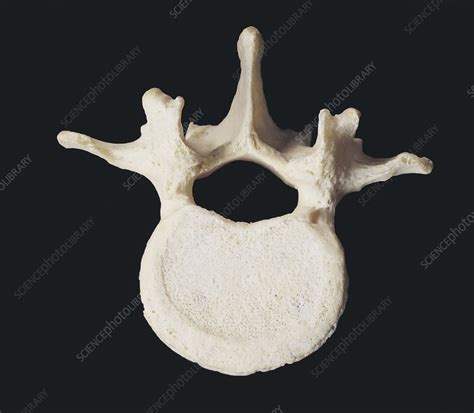 Lumbar vertebra of the spine (L2) - Stock Image - C008/6229 - Science ...