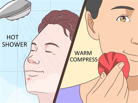 how to get rid of under the skin pimples 14
