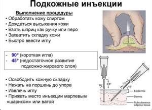 Как делать уколы внутримышечно: самому себе, в руку - Травмы