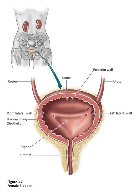 Illustrations - Bladder Cancer