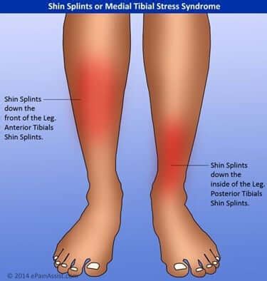 shin leg