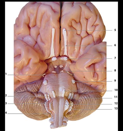 [Solved] Please Label. 5 6 7 8 9 2 10 3 11 4 12 13 | Course Hero
