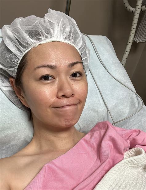 joanna dong  reveals breast cancer scare misses st ndp rehearsal