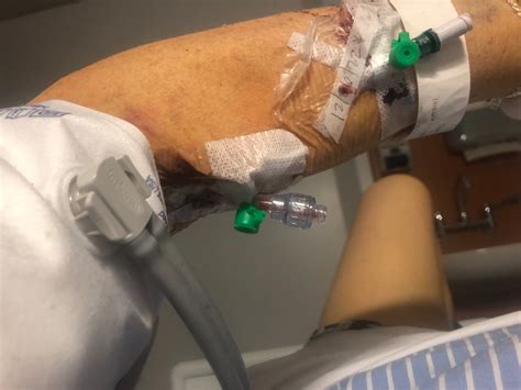 Aideen Kennedy on Twitter: "Day 19 in hospital - say a wee prayer for