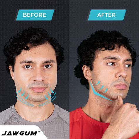 5 Best Chewing Gum For Jawline 2023 - Helpful Advice & Tips