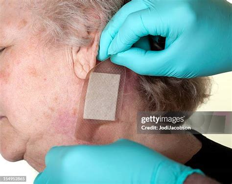 bandaged ear   premium high res pictures getty images
