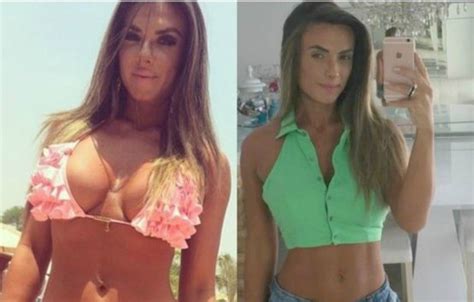 Nicole Bahls Antes E Depois - Nicole Bahls Antes E Depois