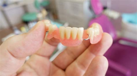 What Is A Partial Denture – Forbes Health