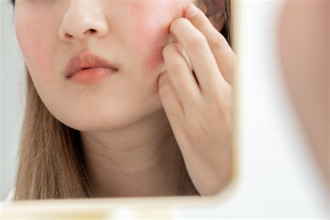 Skincare Que Es 6