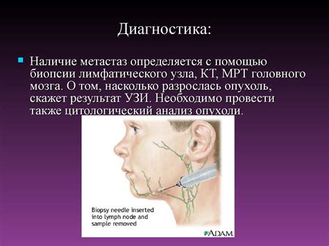 Рак языка - презентация онлайн
