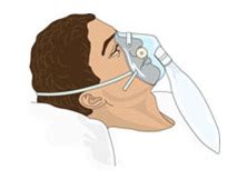 Oxygen + intubation - procedures 4 Flashcards | Quizlet