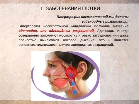 Анатомическое строение, функции и патологии ротовой полости - online ...