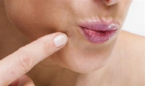 genital warts  lips