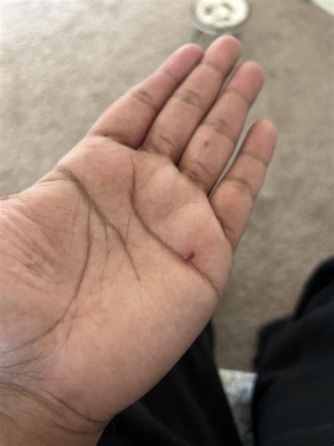 All Things Wound Care