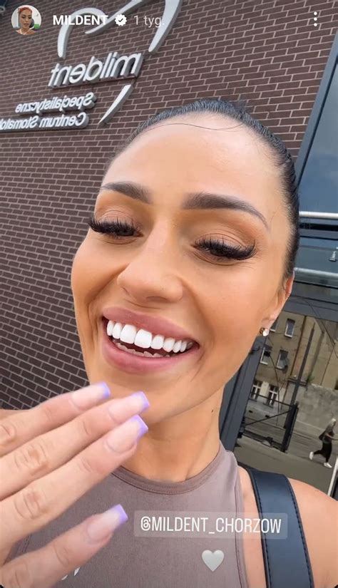 beata kurpas  love island zrobila sobie nowe zeby fortepian ibisza