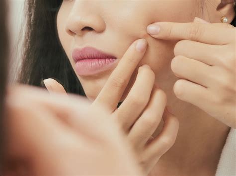 Popped Pimple