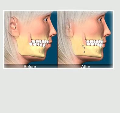 Truth Dental Clinic | Truth About Tooth